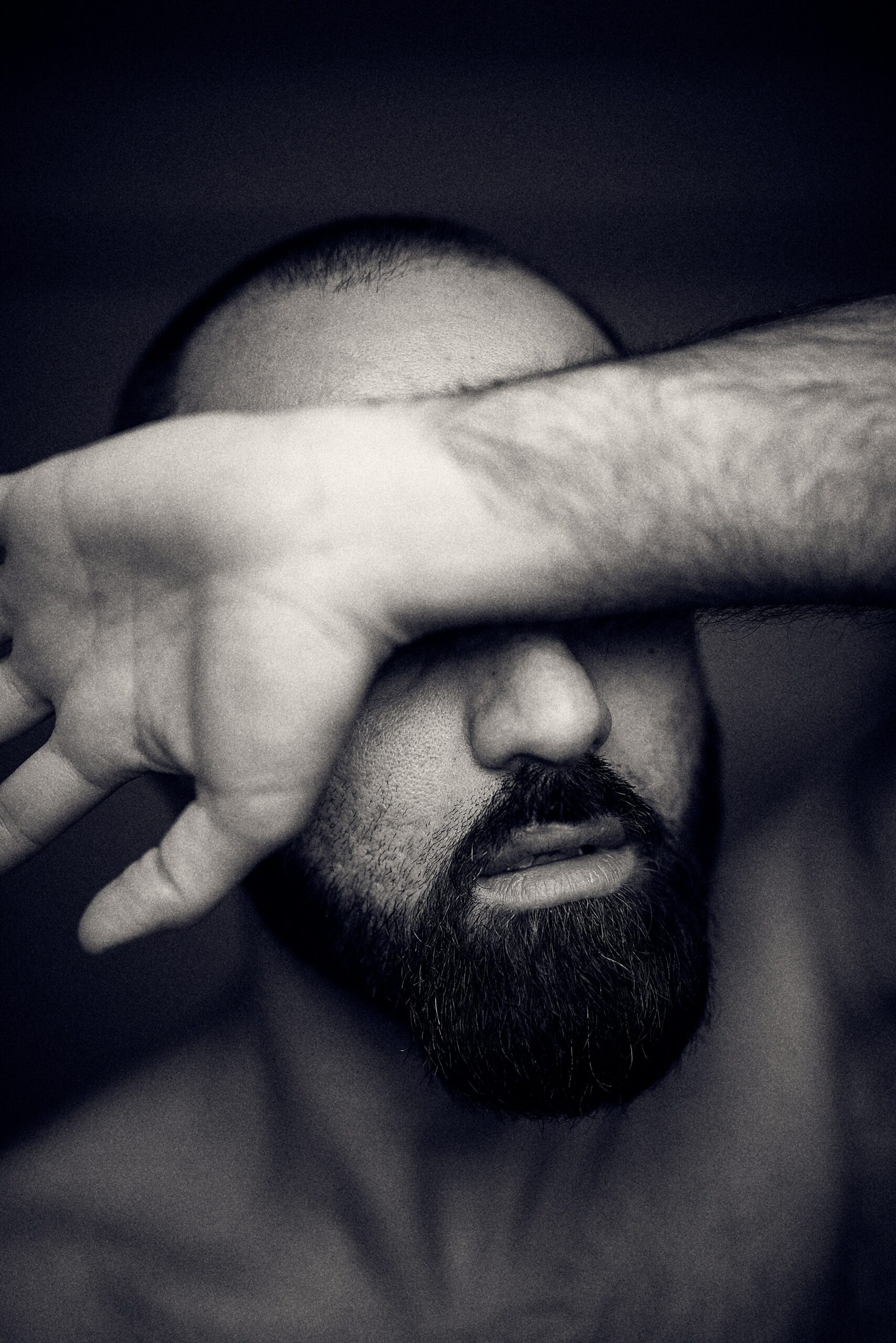 "Distressed man covering his face with his arm, symbolizing anxiety and emotional overwhelm in black and white."